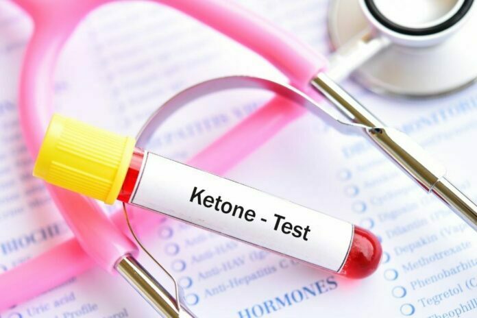 Appearence of ketone bodies in urine are signs of ketosis